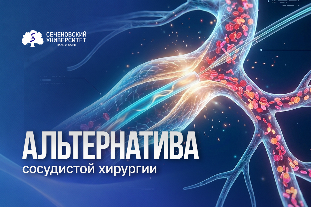 В Сеченовском Университете изучили малоинвазивную альтернативу операции для лечения вен на лице и шее