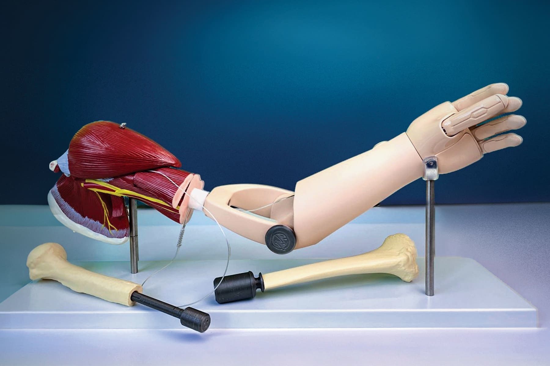 Проект «Моторика ОРТО» и СамГМУ выиграл грант в конкурсе РНФ и Газпромбанка